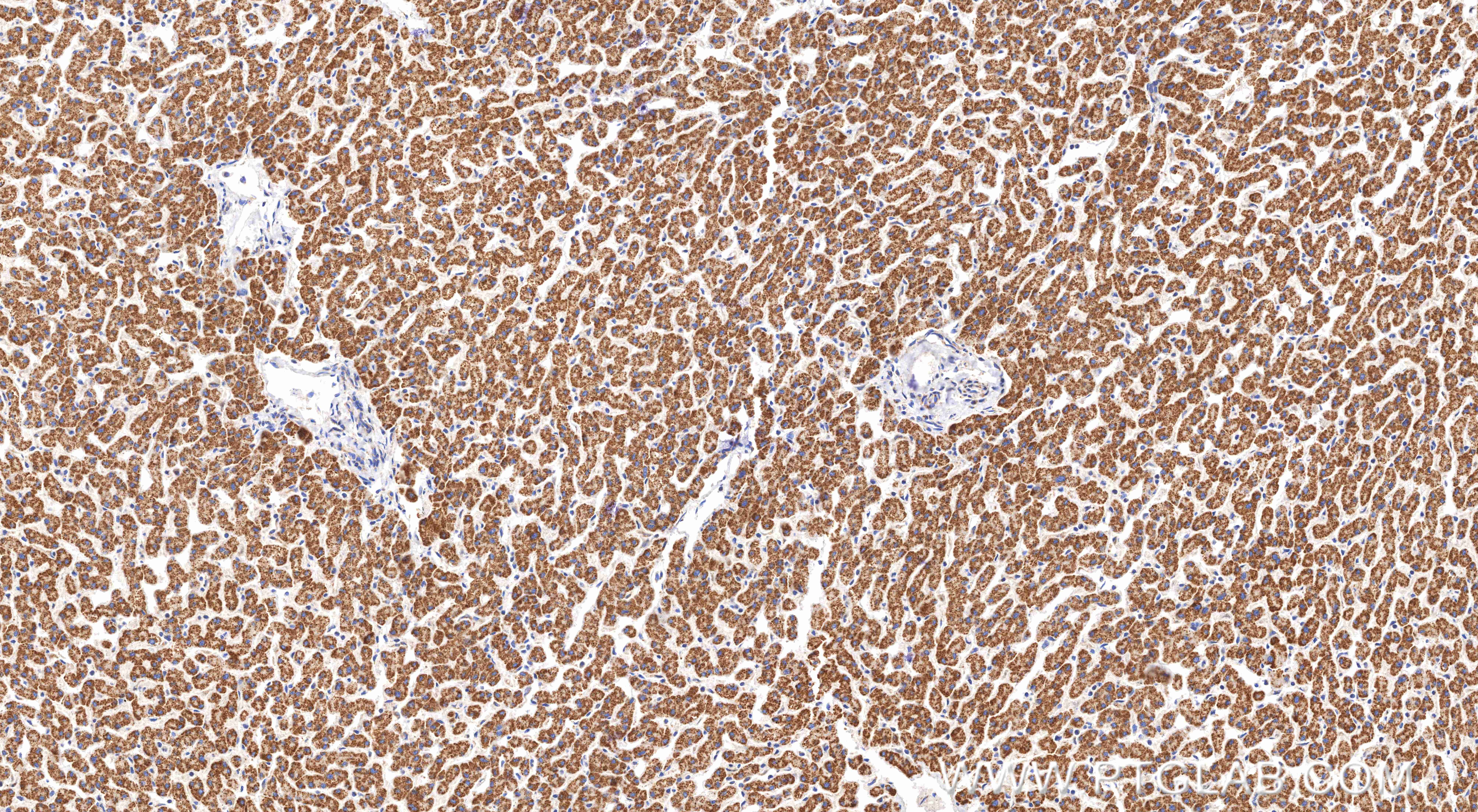 IHC staining of human liver using 82122-5-RR
