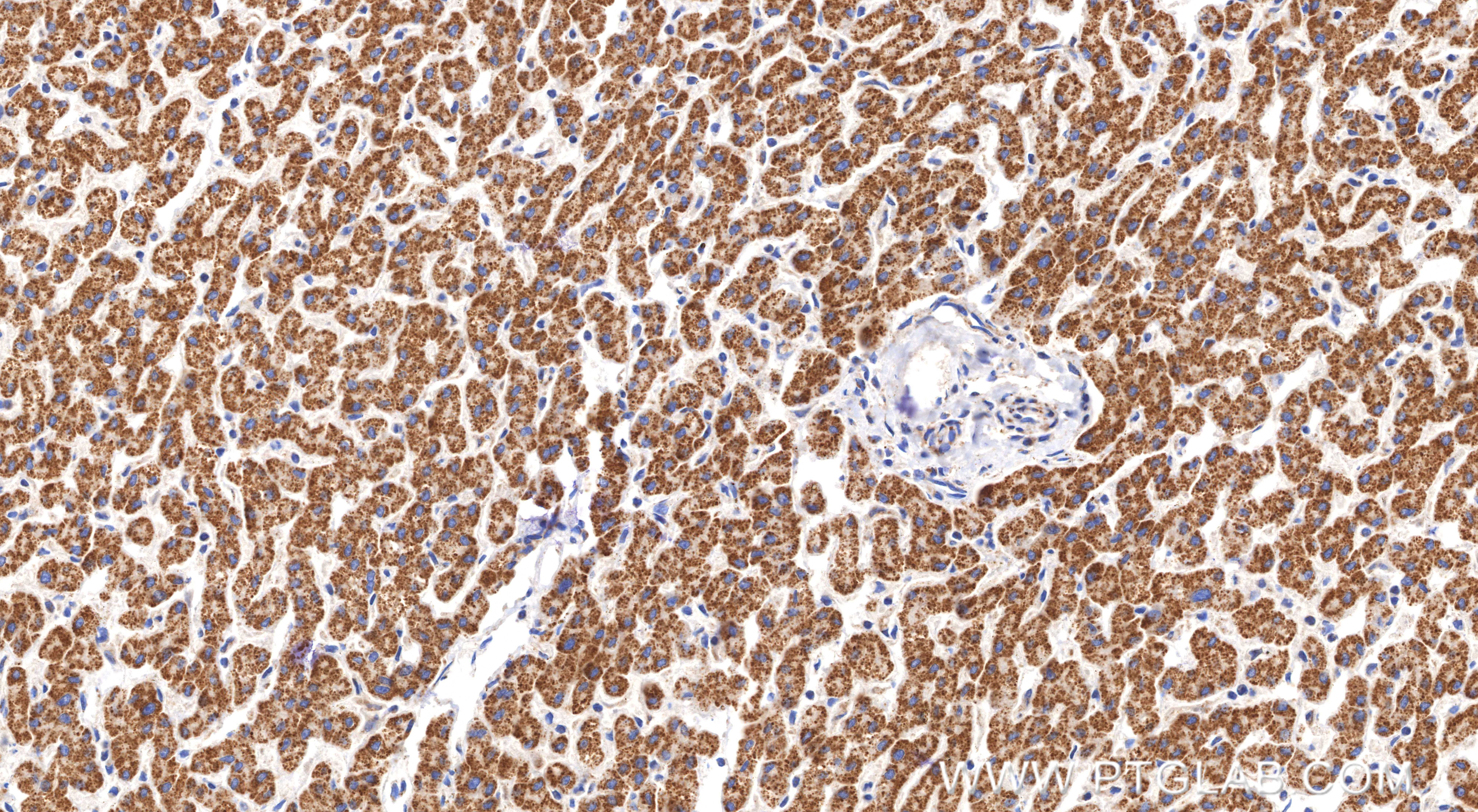 IHC staining of human liver using 82122-5-RR