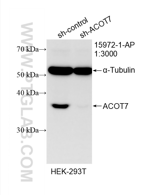 WB analysis of HEK-293T using 15972-1-AP WB analysis of HEK-293T using 15972-1-AP