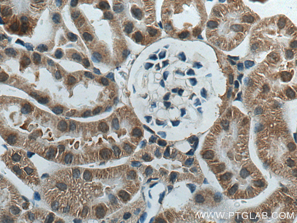 IHC staining of mouse kidney using 15901-1-AP