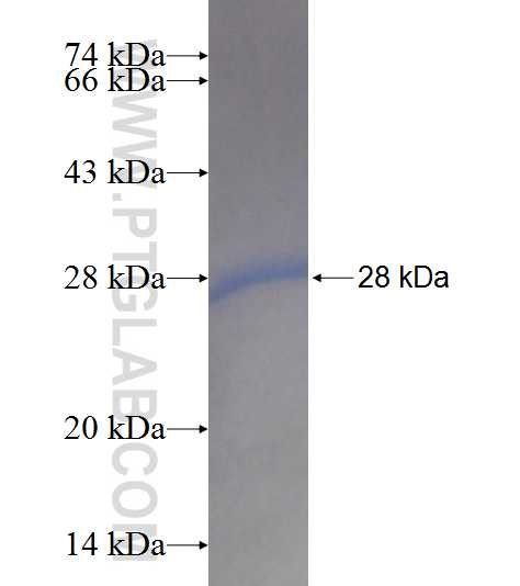 ACOT9 fusion protein Ag8884 SDS-PAGE