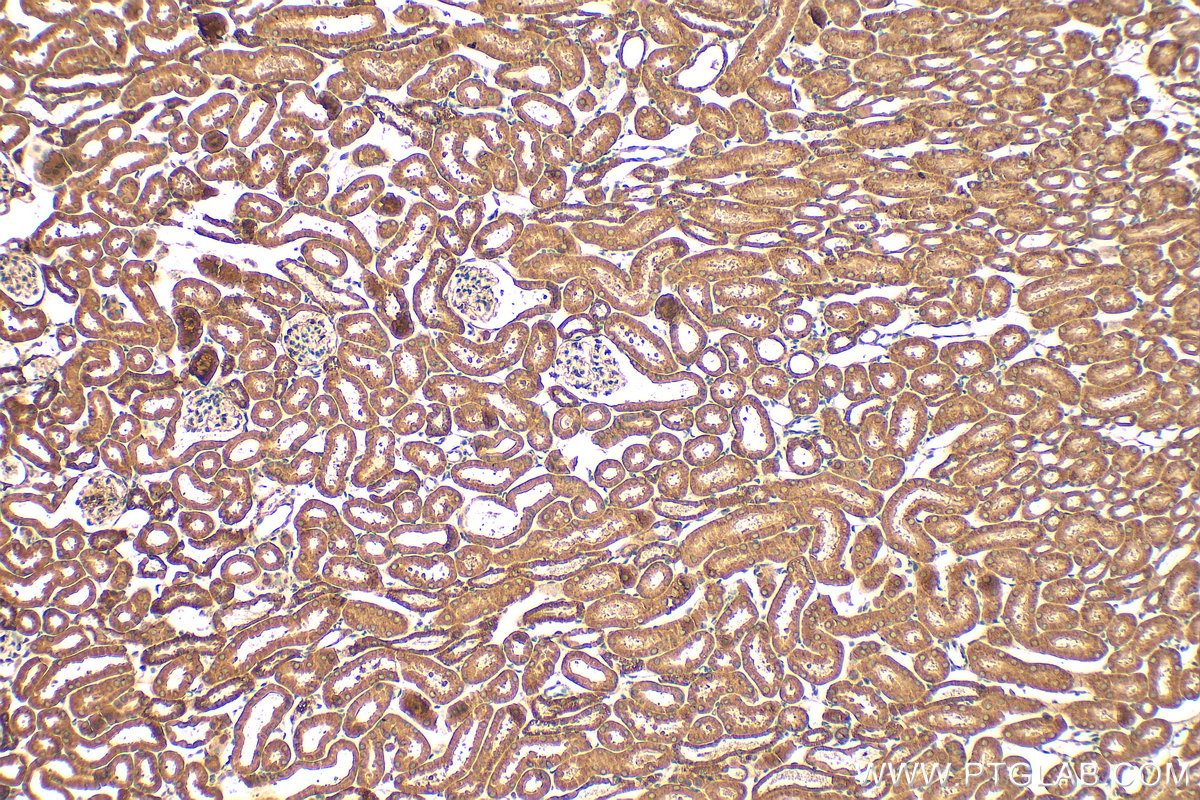 IHC staining of mouse kidney using 68017-1-Ig (same clone as 68017-1-PBS)