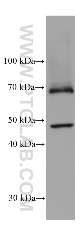 WB analysis of rat liver using 68017-1-Ig (same clone as 68017-1-PBS)