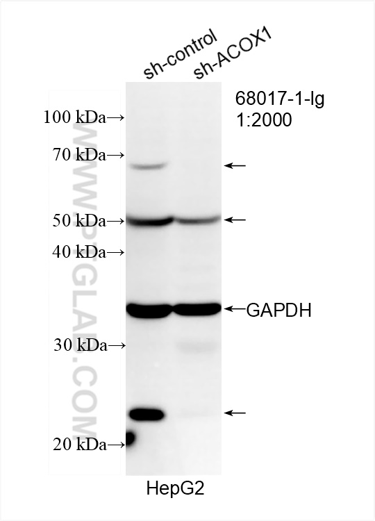 WB analysis of HepG2 using 68017-1-Ig (same clone as 68017-1-PBS)