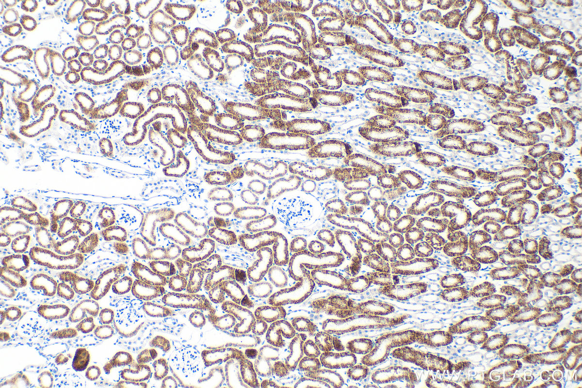 Immunohistochemical analysis of paraffin-embedded mouse kidney tissue slide using 83731-1-RR (ACOX1 antibody) at dilution of 1:500 (under 10x lens). Heat mediated antigen retrieval with Tris-EDTA buffer (pH 9.0). IHC staining of mouse kidney using 83731-1-RR