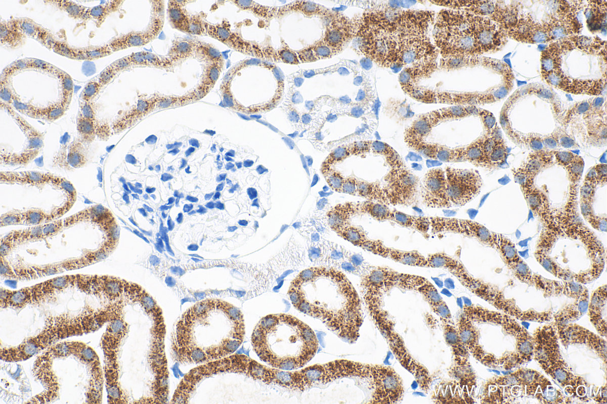 Immunohistochemical analysis of paraffin-embedded mouse kidney tissue slide using 83731-1-RR (ACOX1 antibody) at dilution of 1:500 (under 40x lens). Heat mediated antigen retrieval with Tris-EDTA buffer (pH 9.0). IHC staining of mouse kidney using 83731-1-RR
