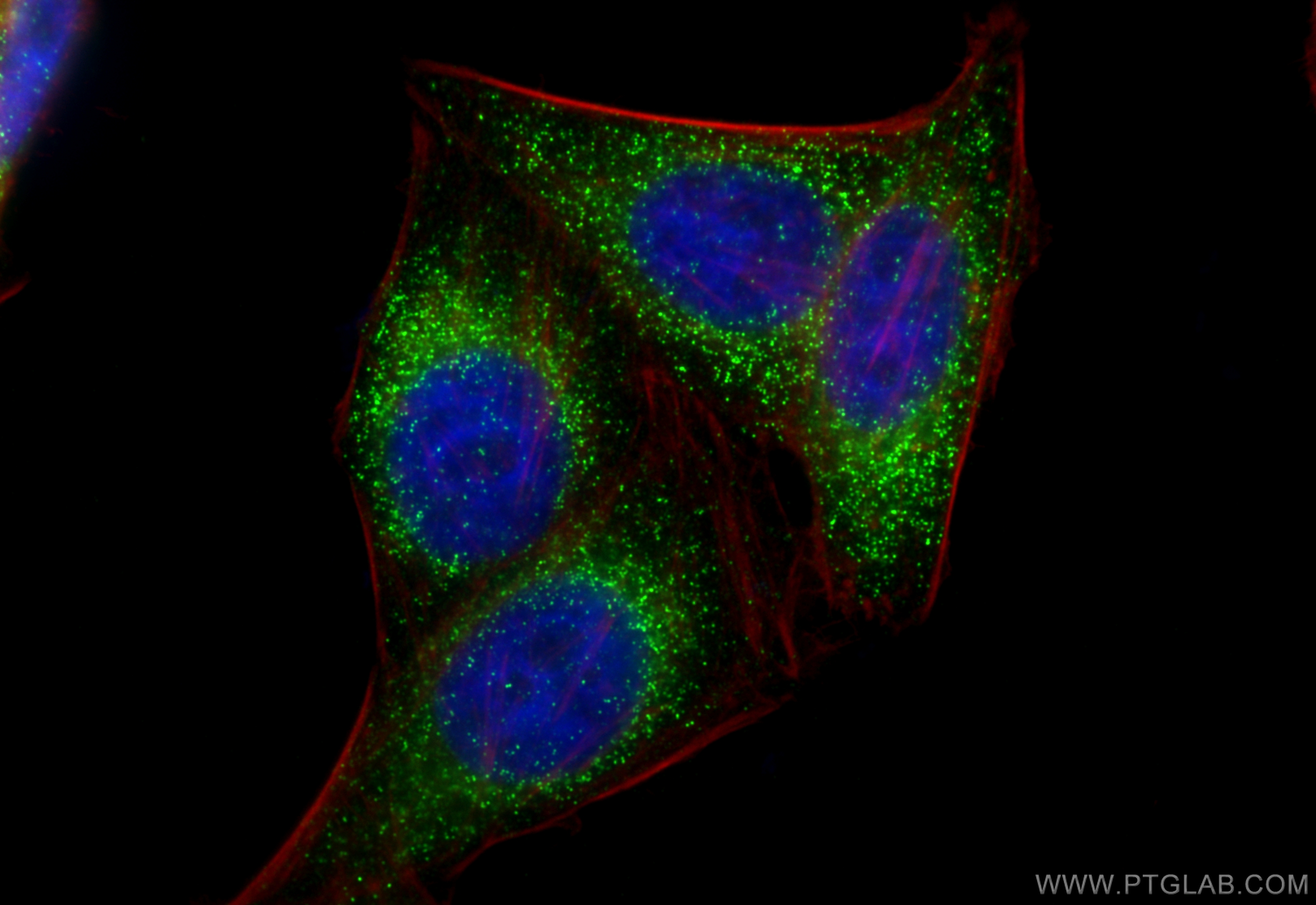 IF Staining of HepG2 using RMX00007