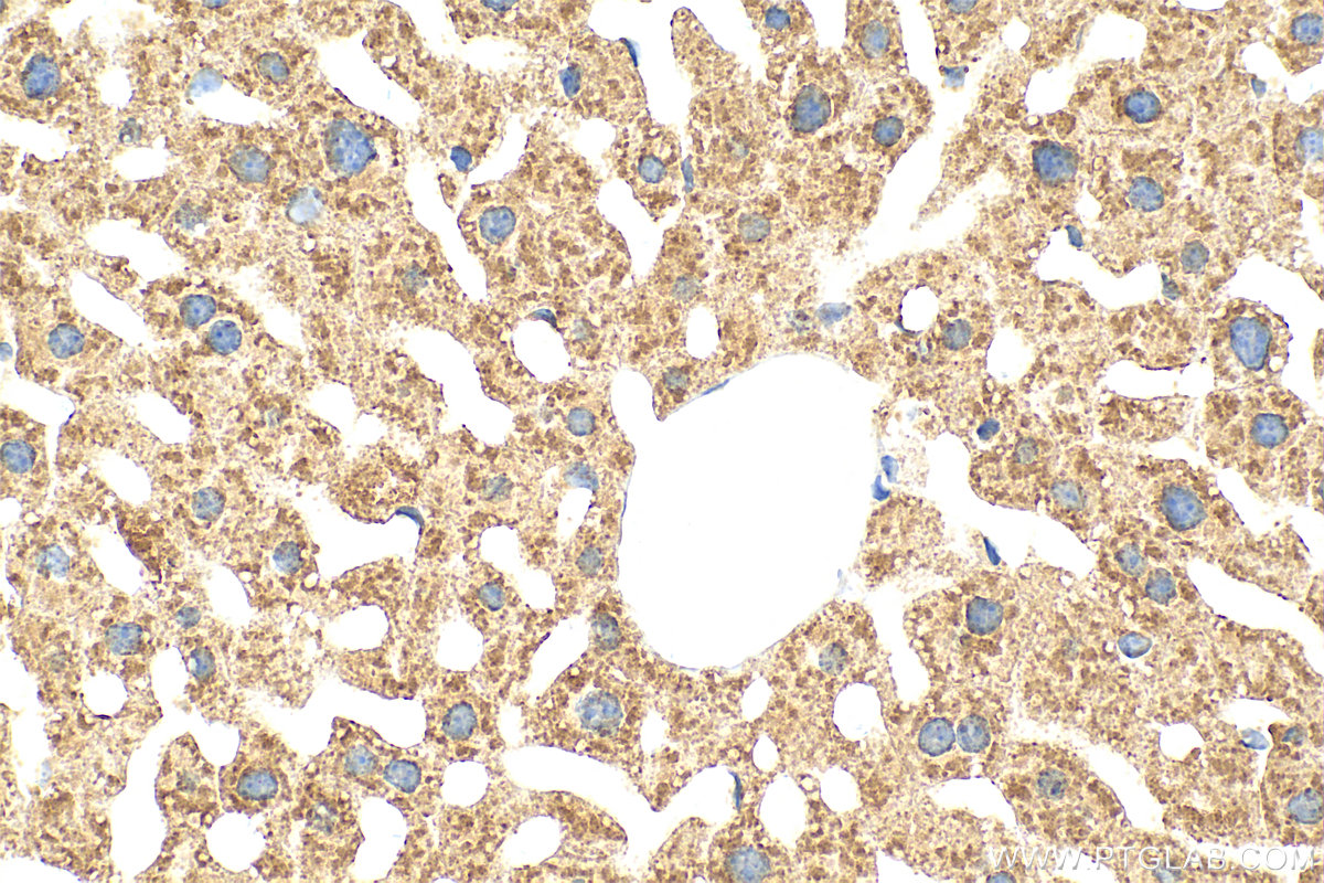 IHC staining of mouse liver using RMX00007