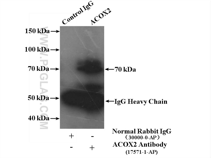 IP experiment of mouse liver using 17571-1-AP