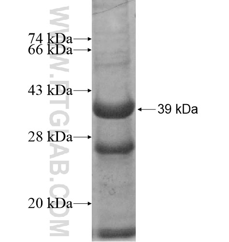 ACOX2 fusion protein Ag11798 SDS-PAGE ACOX2 fusion protein Ag11798 SDS-PAGE