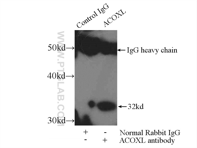 IP experiment of K-562 using 23366-1-AP