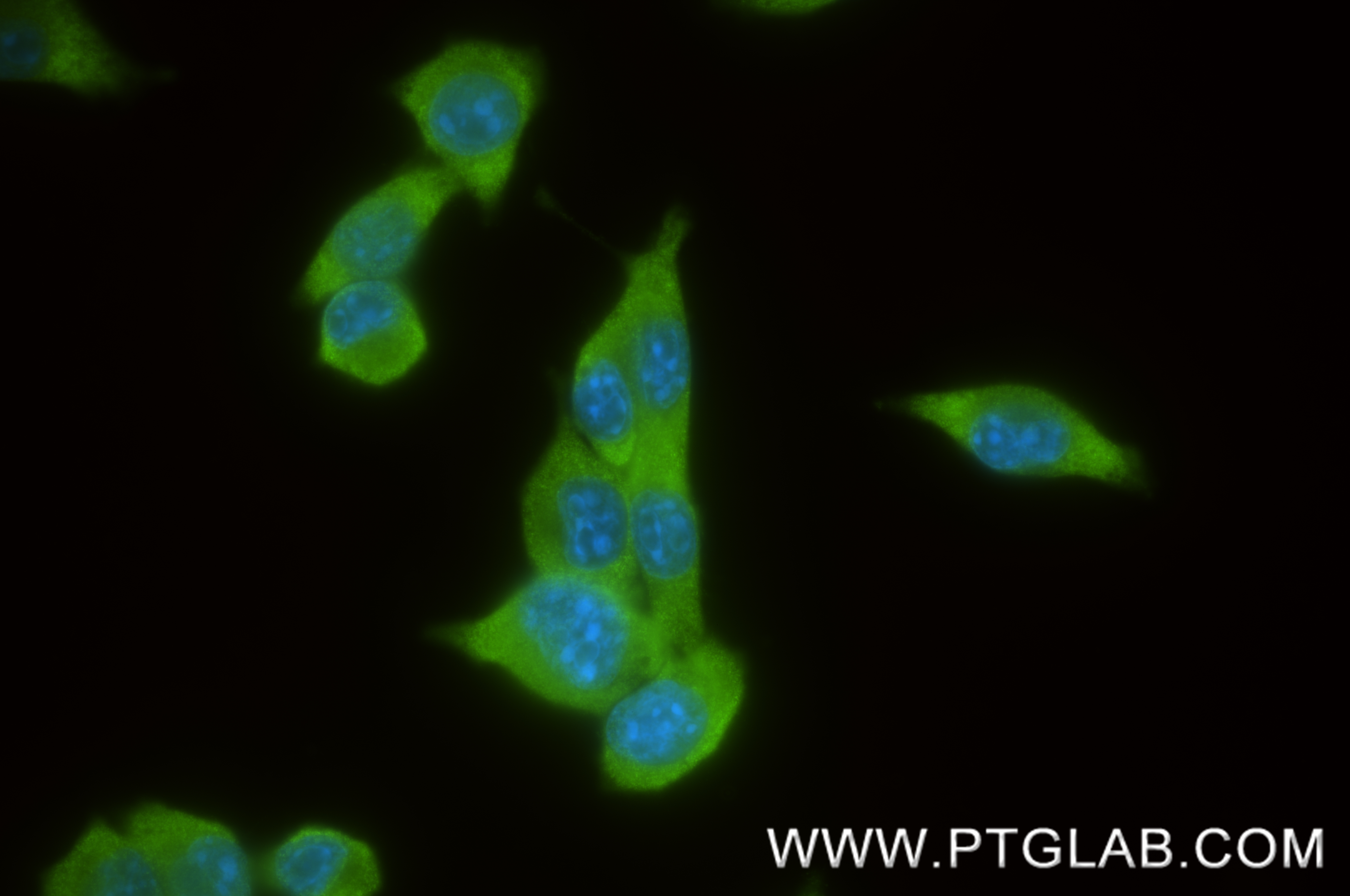 IF Staining of 4T1 using 86817-1-RR (same clone as 86817-1-PBS) IF Staining of 4T1 using 86817-1-RR (same clone as 86817-1-PBS)