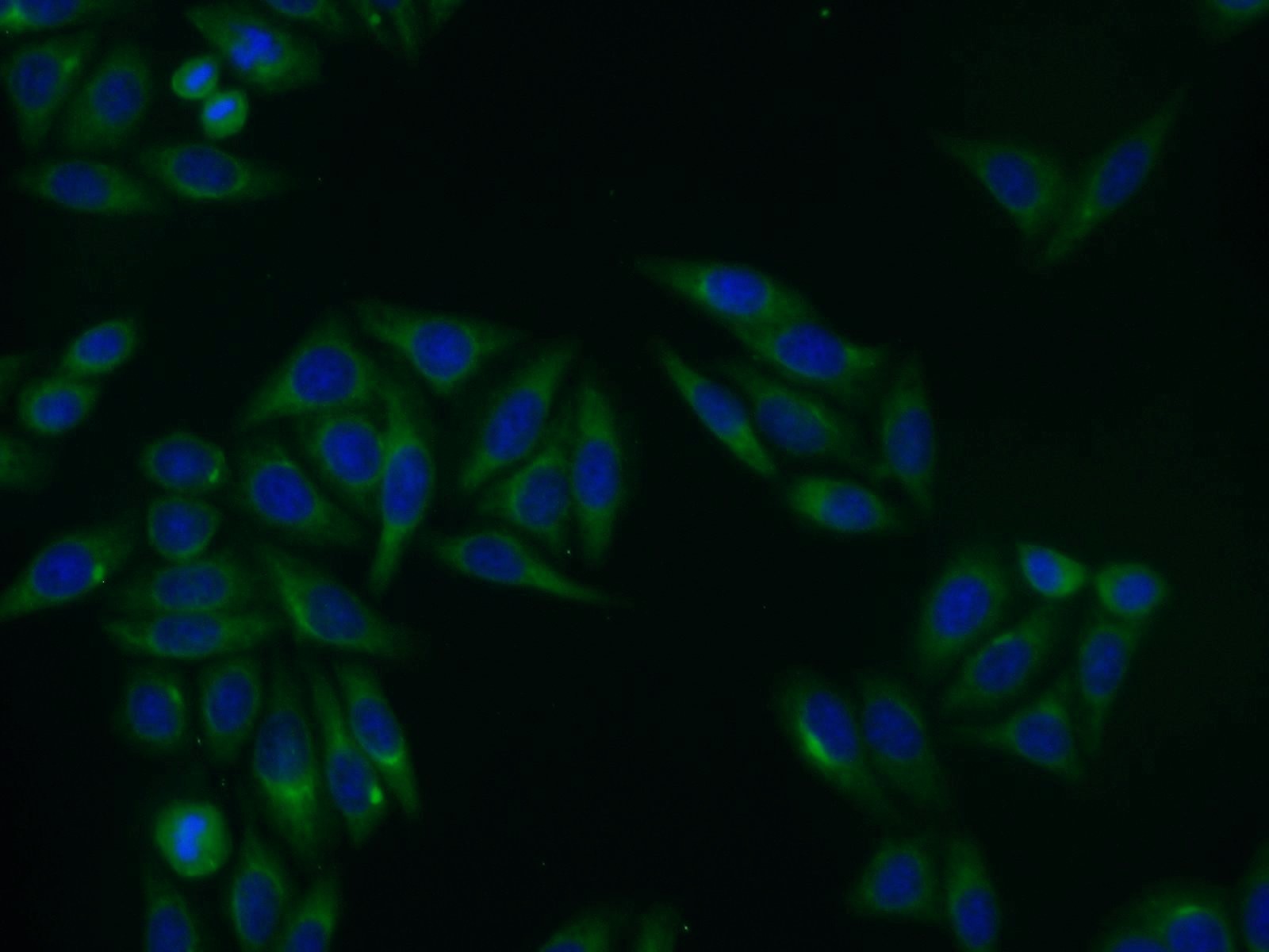 IF Staining of HepG2 using 15236-1-AP