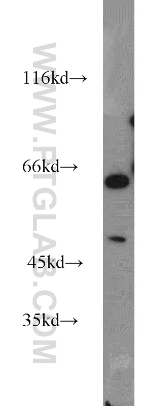 WB analysis of mouse kidney using 15236-1-AP