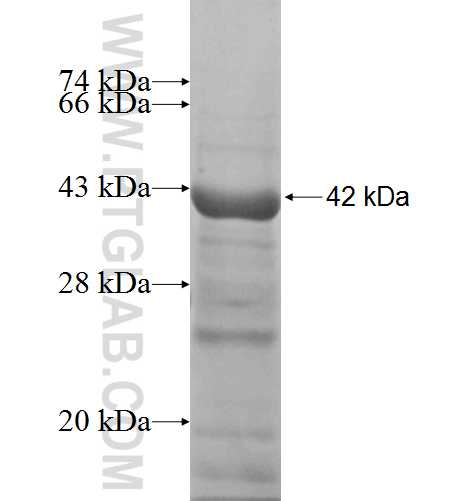 ACP2 fusion protein Ag7523 SDS-PAGE