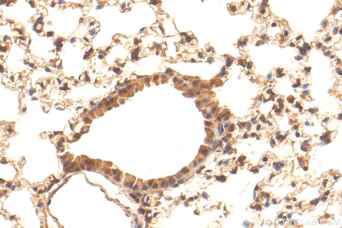 IHC staining of mouse lung using 11594-1-AP