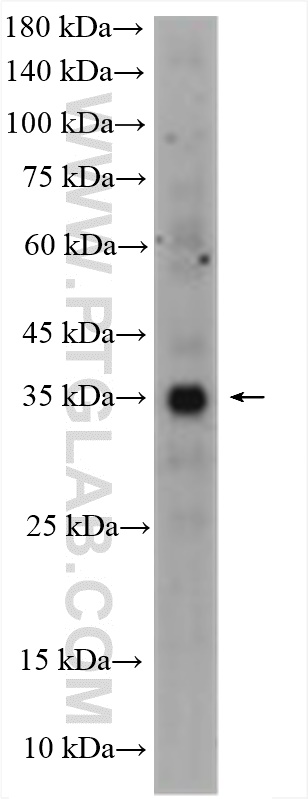 WB analysis using 11594-1-AP