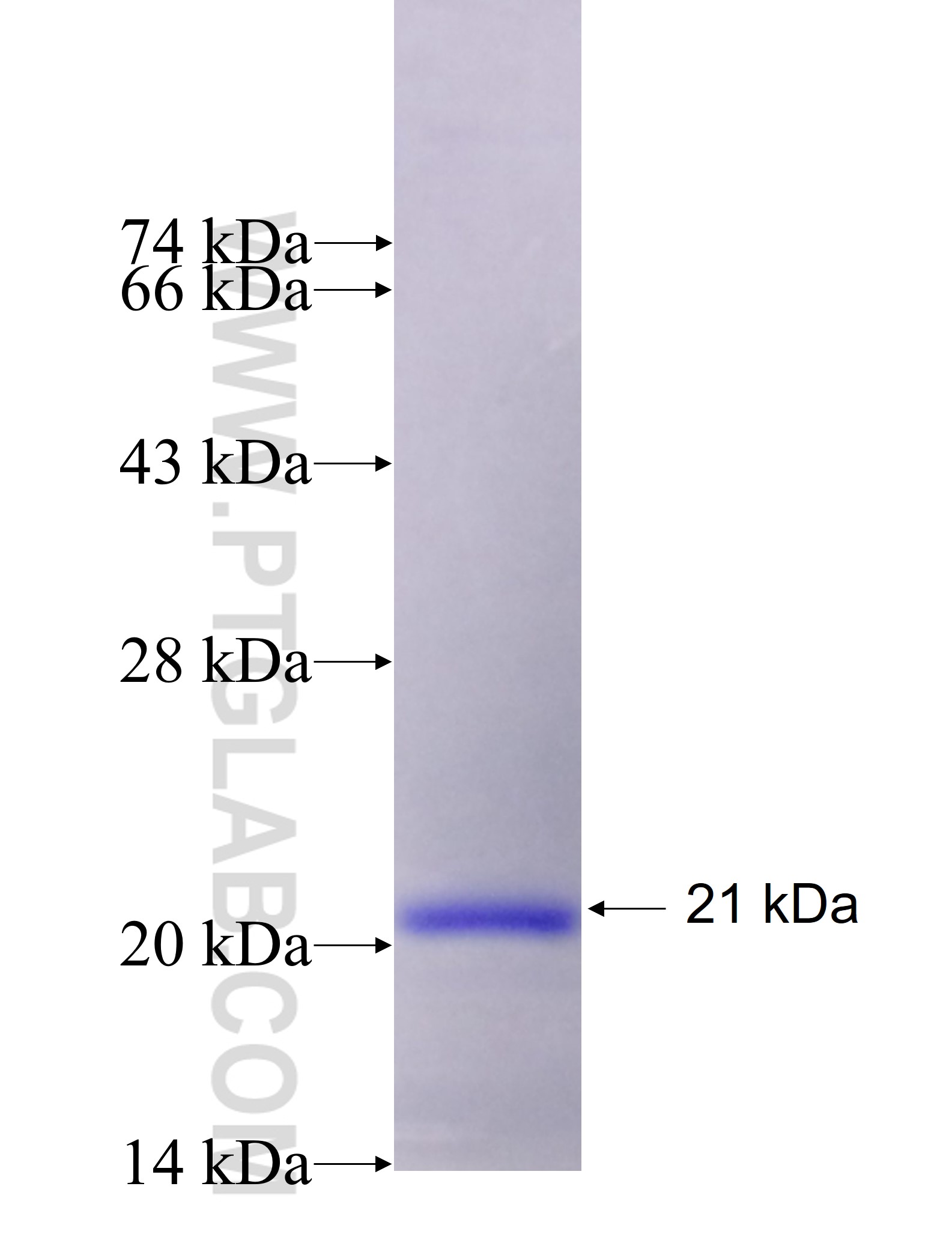 ACP5 fusion protein Ag27474 SDS-PAGE