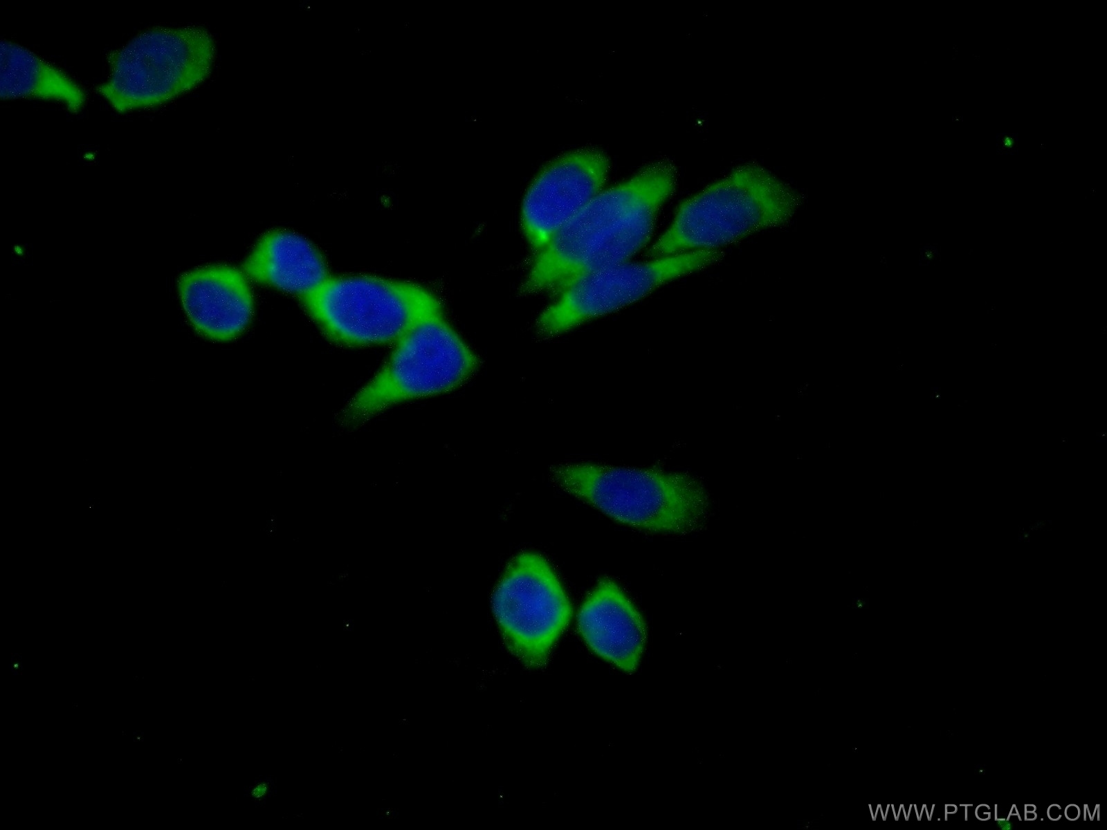 IF Staining of PC-3 using 15840-1-AP