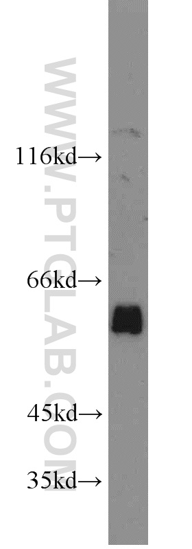WB analysis of PC-3 using 15840-1-AP