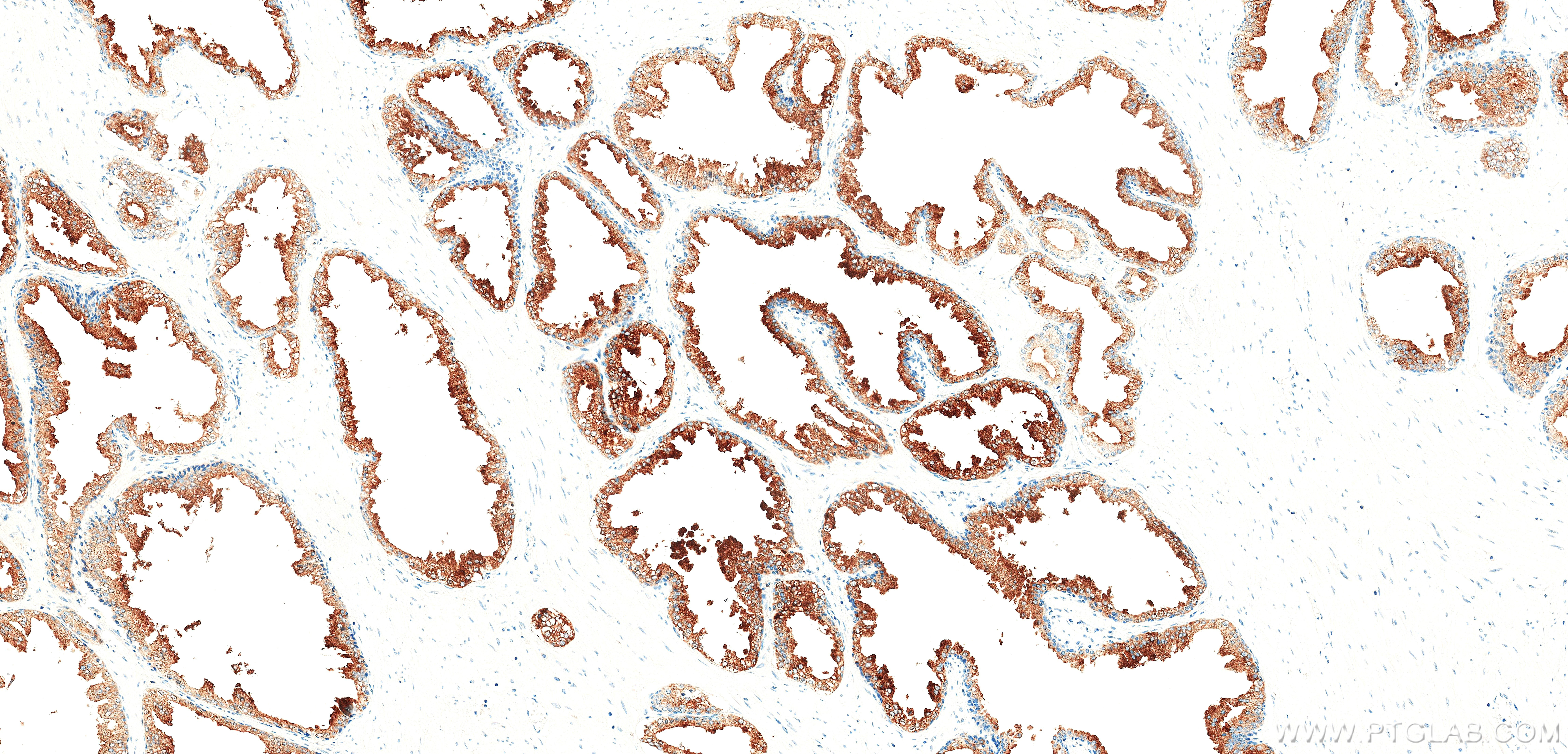 IHC staining of human prostate using 87842-1-RR (same clone as 87842-1-PBS) IHC staining of human prostate using 87842-1-RR (same clone as 87842-1-PBS)