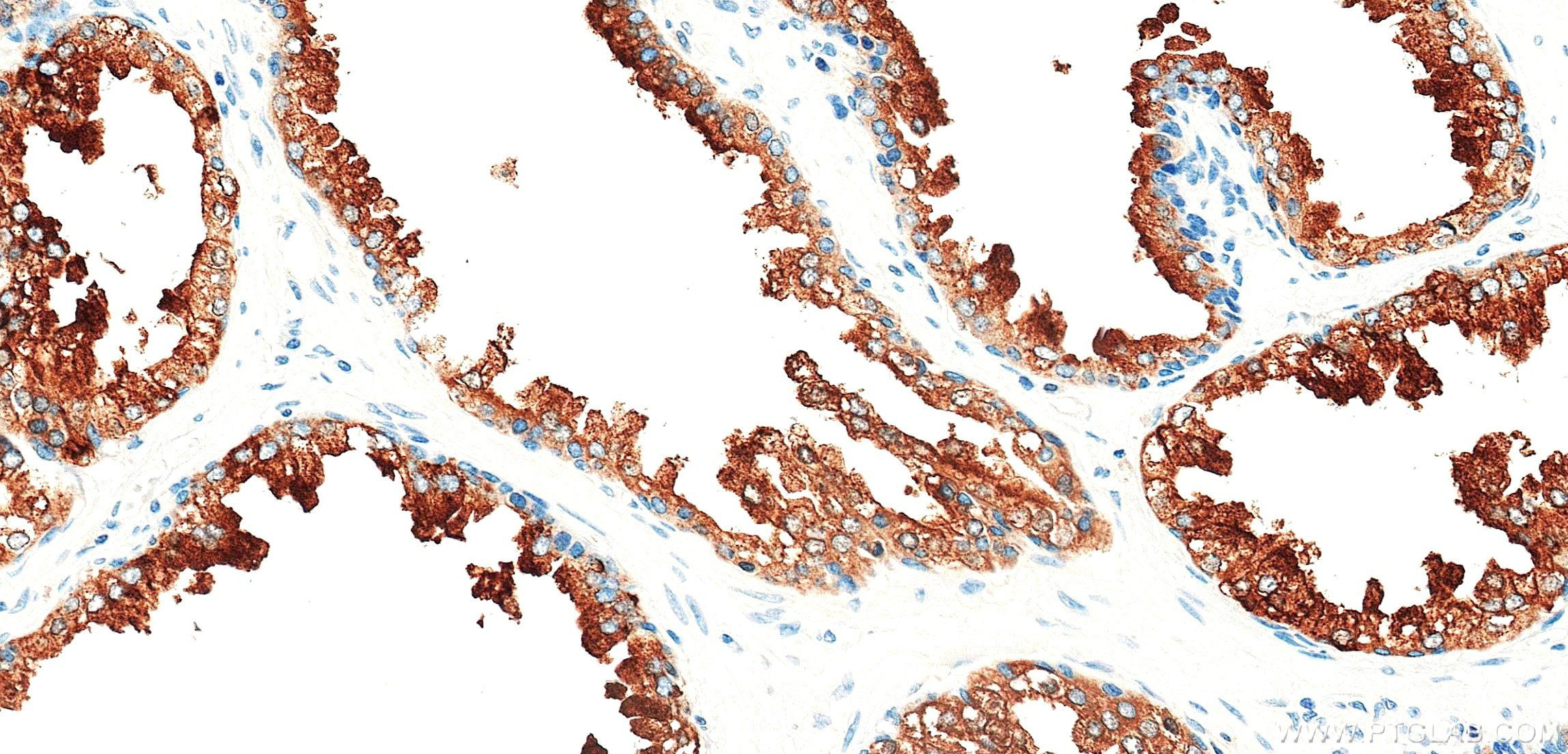 IHC staining of human prostate using 87842-1-RR (same clone as 87842-1-PBS) IHC staining of human prostate using 87842-1-RR (same clone as 87842-1-PBS)