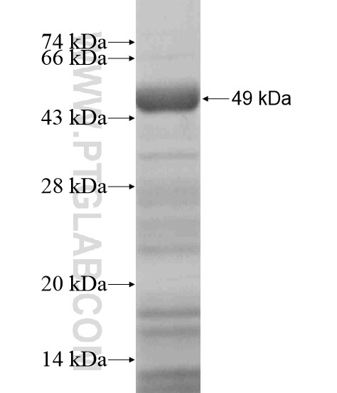 ACPP fusion protein Ag19701 SDS-PAGE