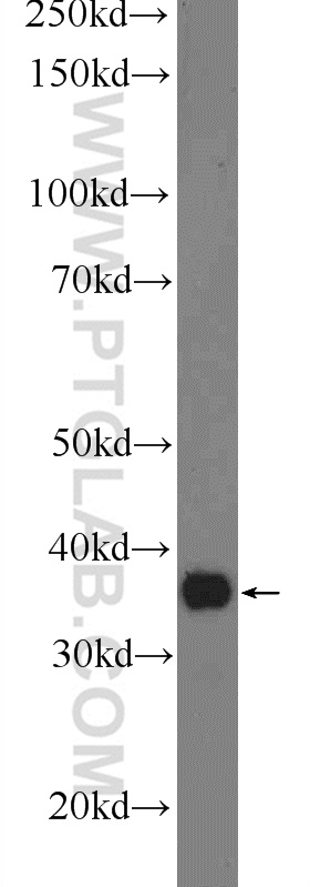 WB analysis of mouse liver using 24326-1-AP