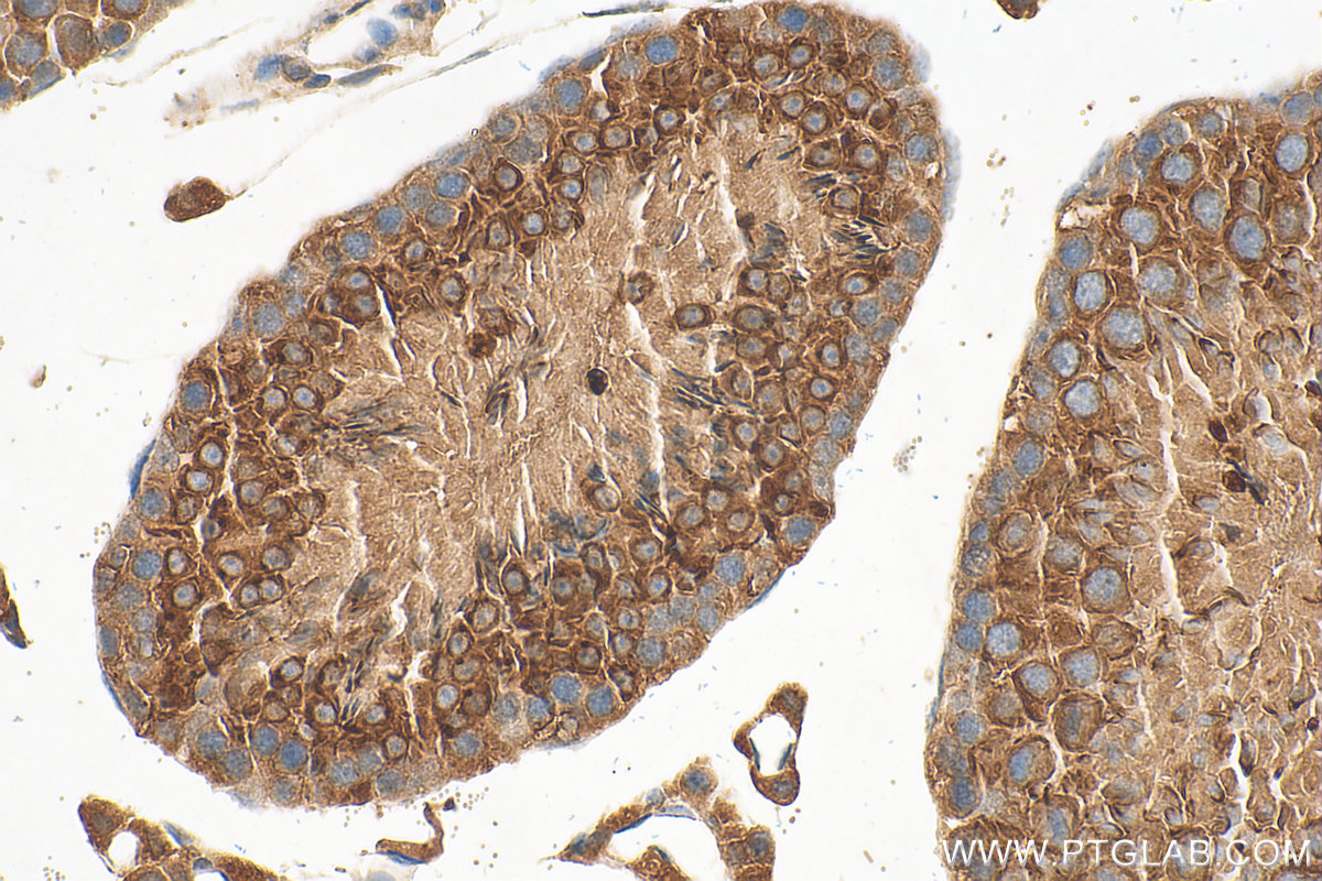 IHC staining of mouse testis using 12487-1-AP