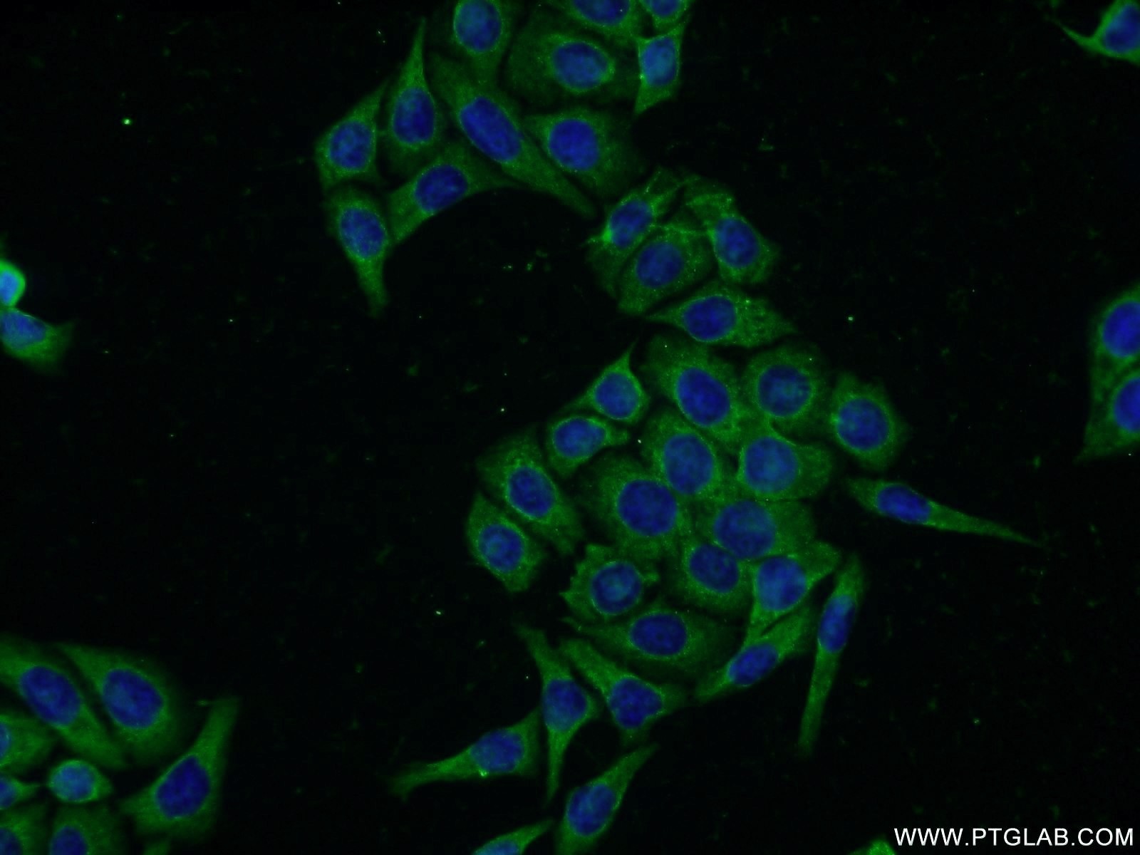 IF Staining of PC-3 using 14040-1-AP