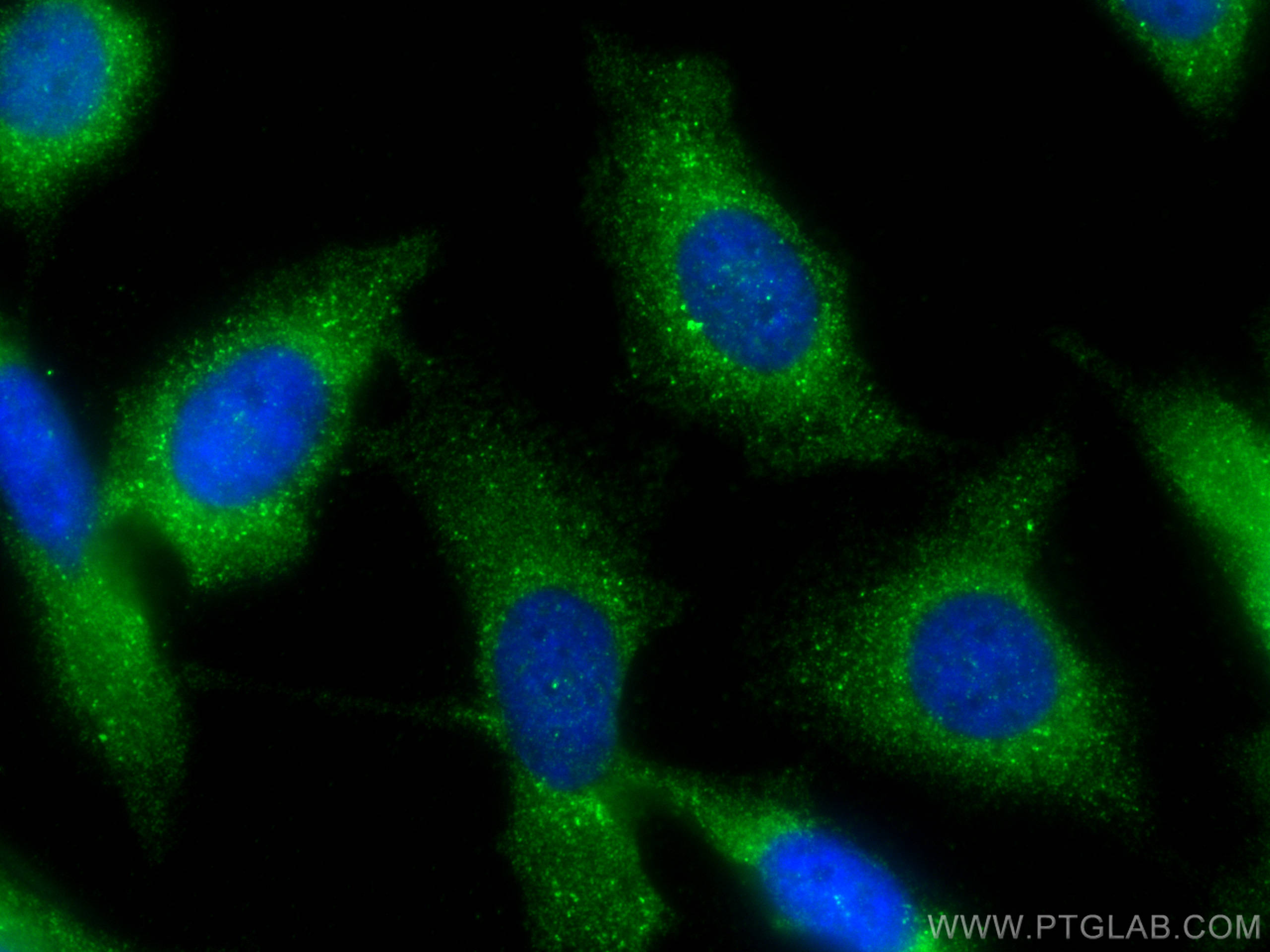 IF Staining of PC-3 using 14040-1-AP