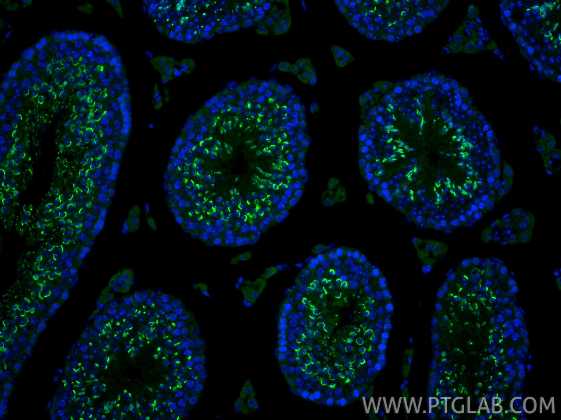 IF Staining of mouse testis using 14040-1-AP IF Staining of mouse testis using 14040-1-AP