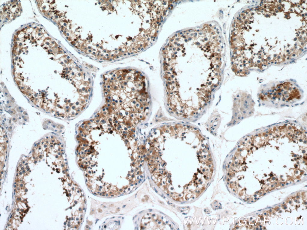 IHC staining of human testis using 14040-1-AP