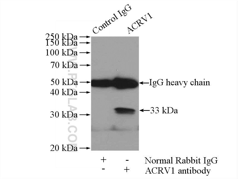 IP experiment of DU 145 using 14040-1-AP