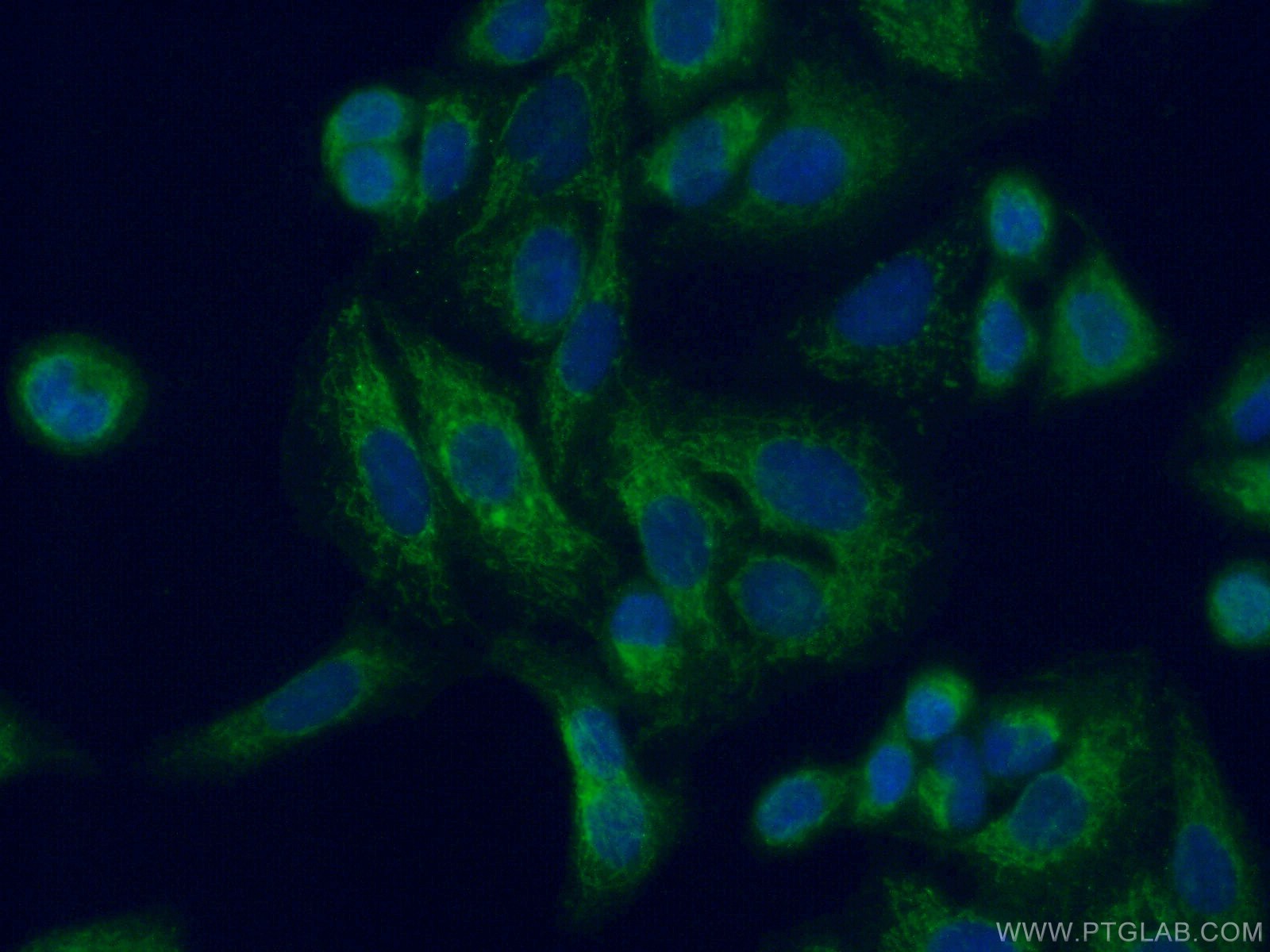 IF Staining of A549 using 16140-1-AP