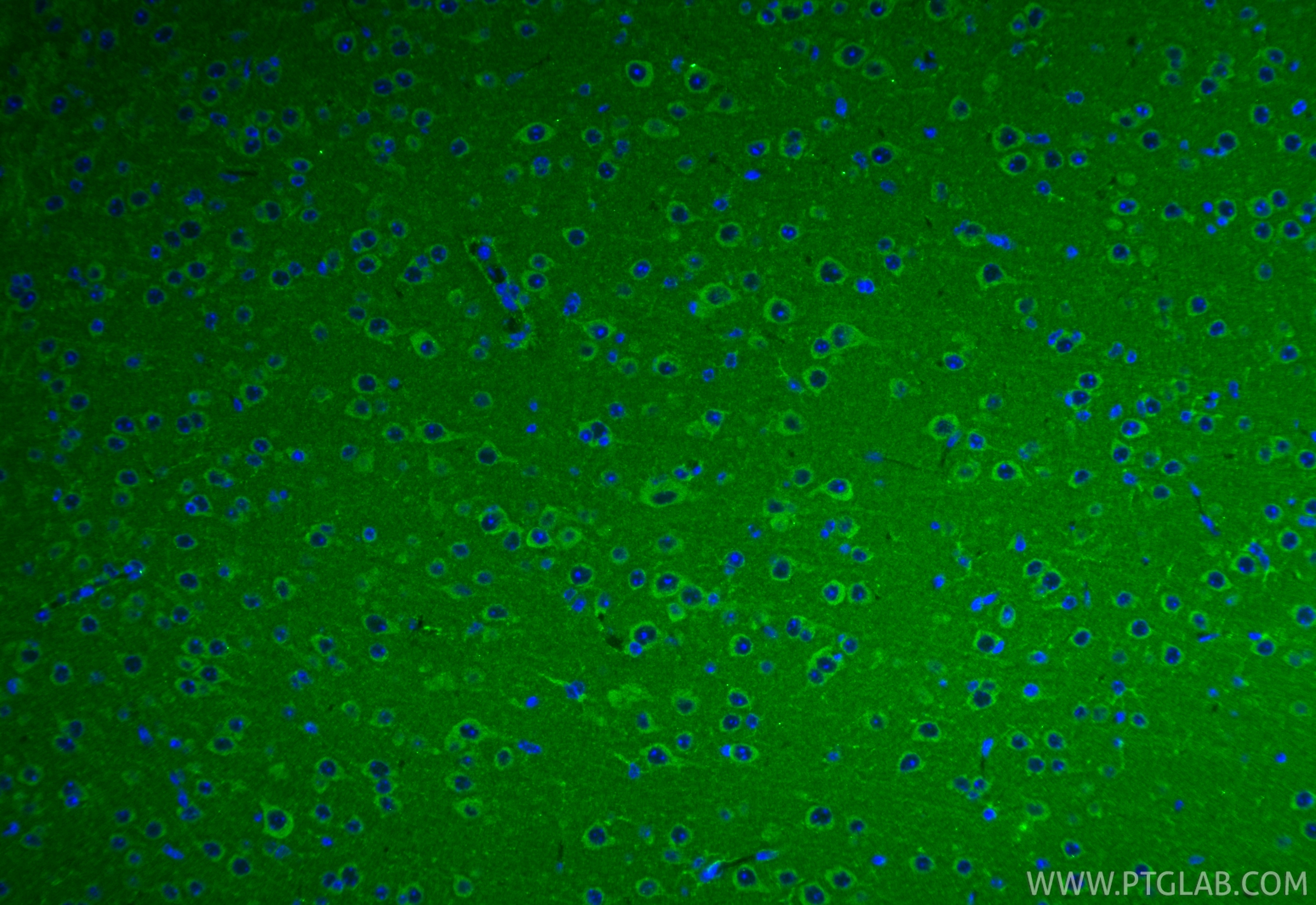 IF Staining of mouse brain using 25484-1-AP