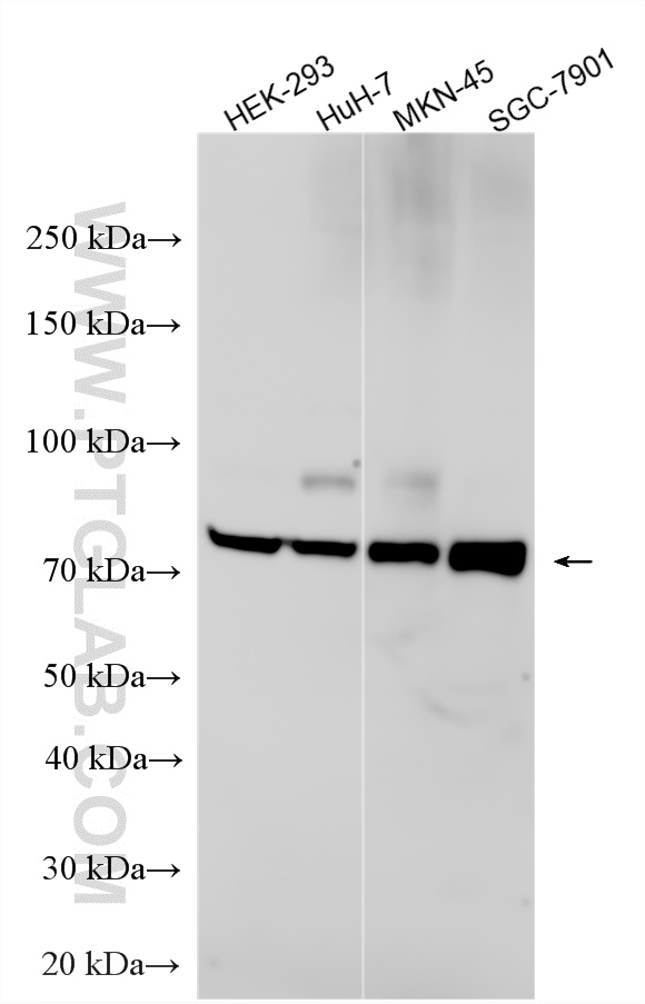 Various lysates were subjected to SDS PAGE followed by western blot with 20710-1-AP (ACSL3 antibody) at dilution of 1:5000 incubated at room temperature for 1.5 hours. WB analysis using 20710-1-AP