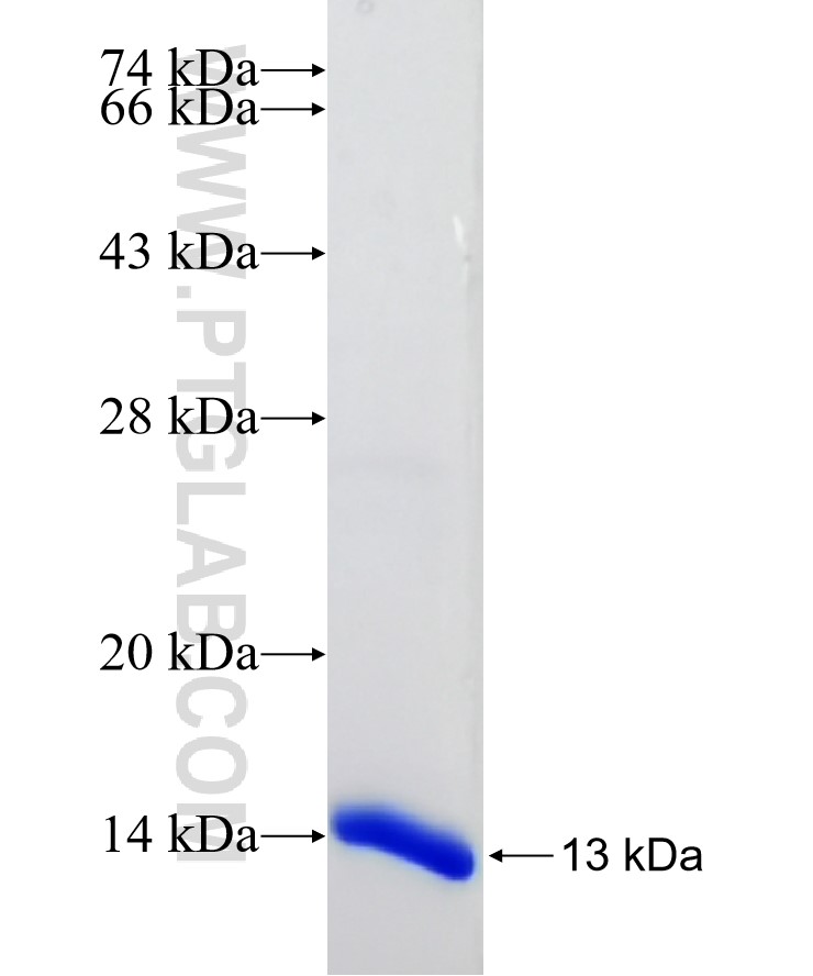 ACSL3 fusion protein Ag33021 SDS-PAGE ACSL3 fusion protein Ag33021 SDS-PAGE