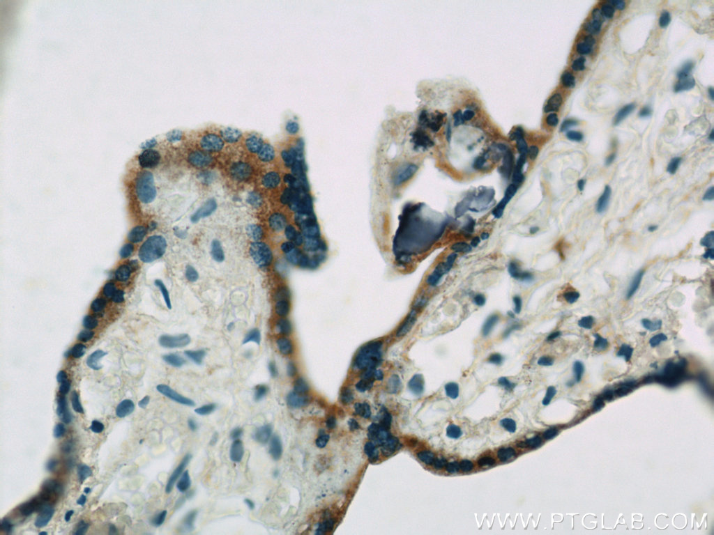 IHC staining of human placenta using 22401-1-AP