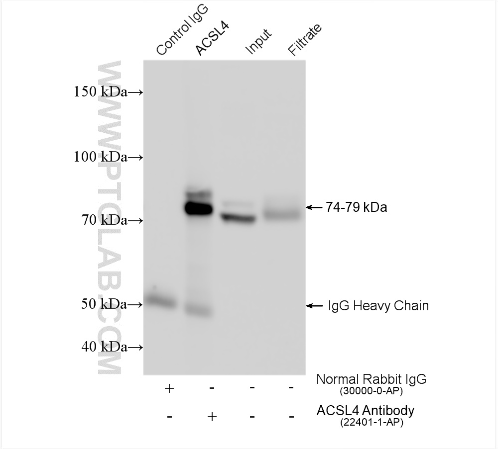 IP experiment of HEK-293 using 22401-1-AP