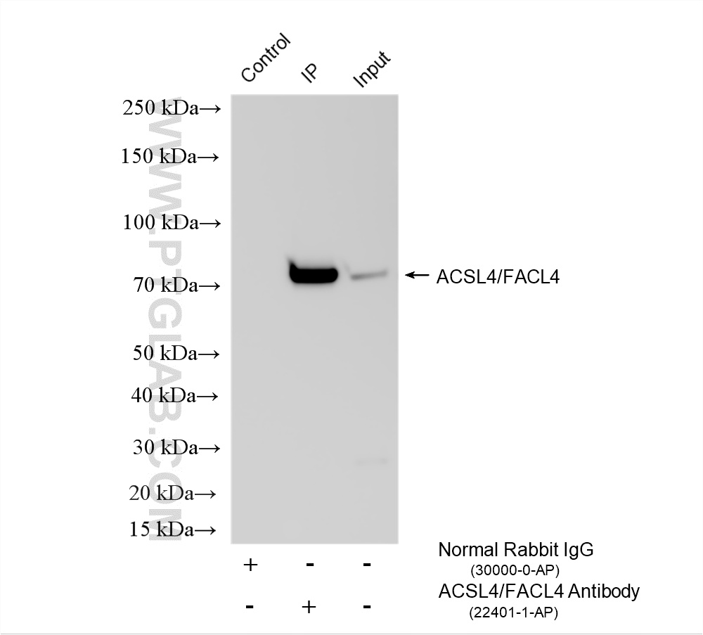 IP experiment of mouse liver using 22401-1-AP IP experiment of mouse liver using 22401-1-AP