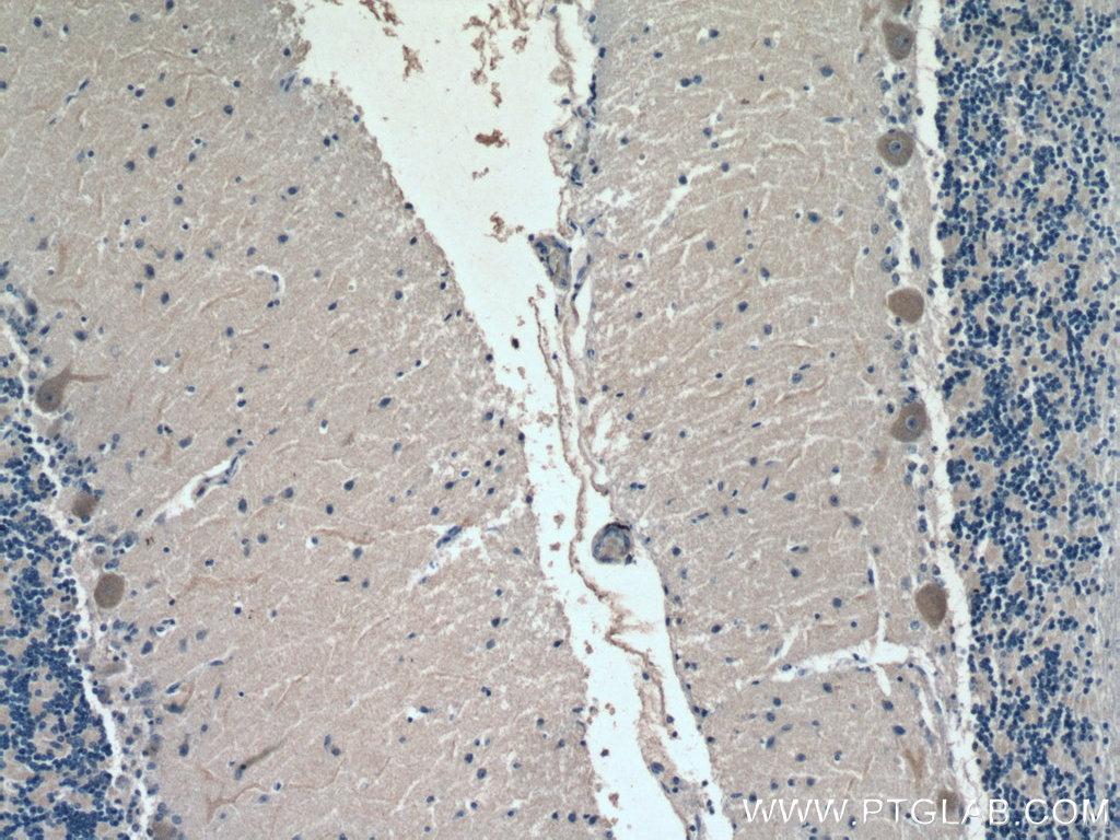 IHC staining of human cerebellum using 66617-1-Ig