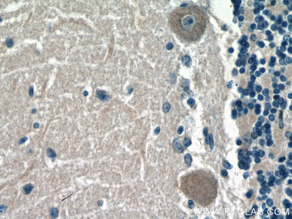 IHC staining of human cerebellum using 66617-1-Ig