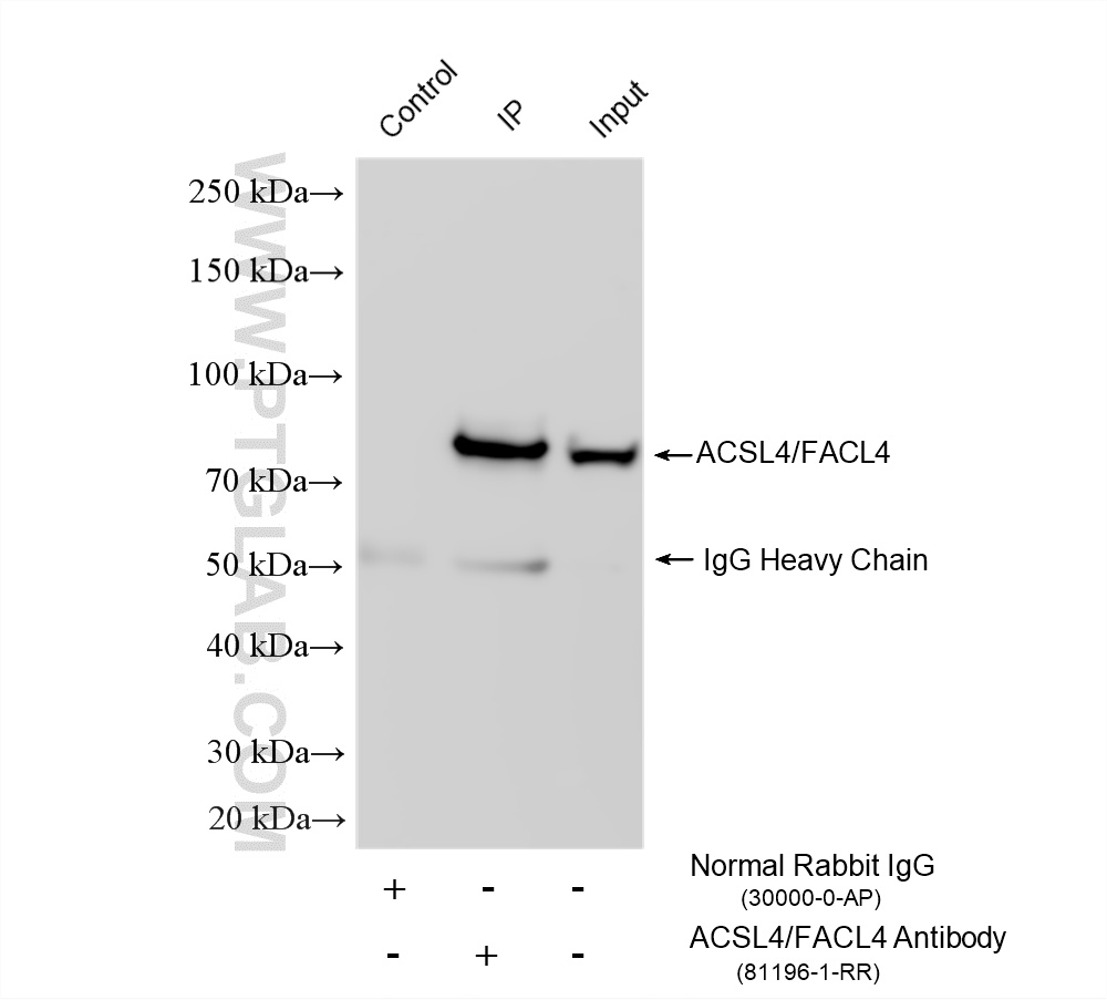 IP experiment of HeLa using 81196-1-RR IP experiment of HeLa using 81196-1-RR