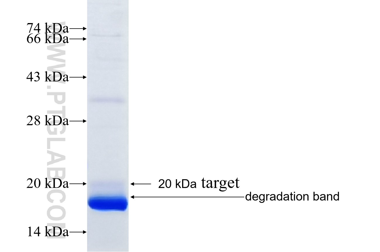 ACSL4 fusion protein Ag18085 SDS-PAGE