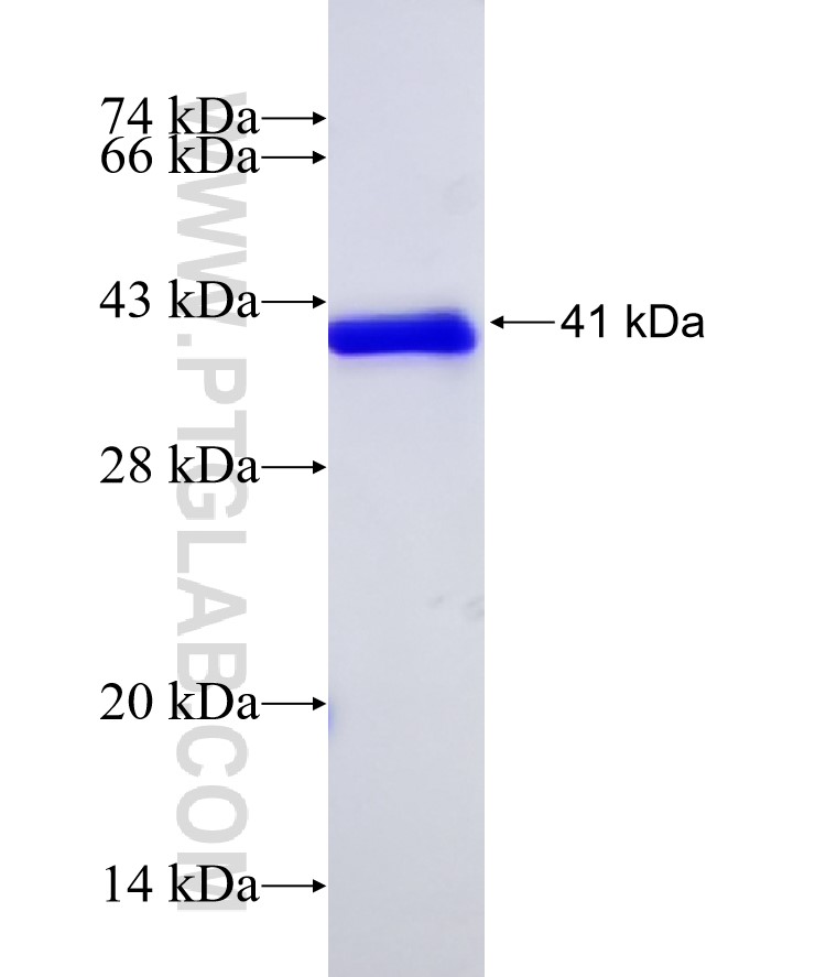ACSL4 fusion protein Ag18483 SDS-PAGE ACSL4 fusion protein Ag18483 SDS-PAGE