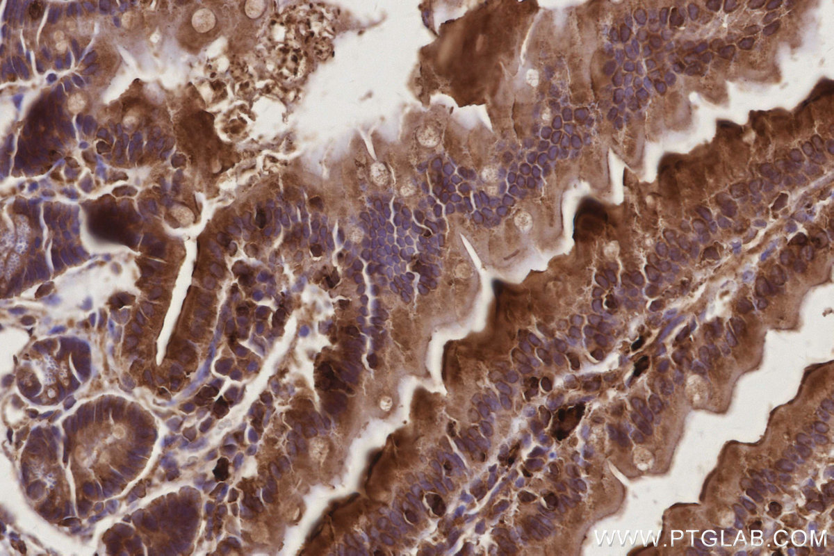 IHC staining of mouse small intestine using 15708-1-AP IHC staining of mouse small intestine using 15708-1-AP