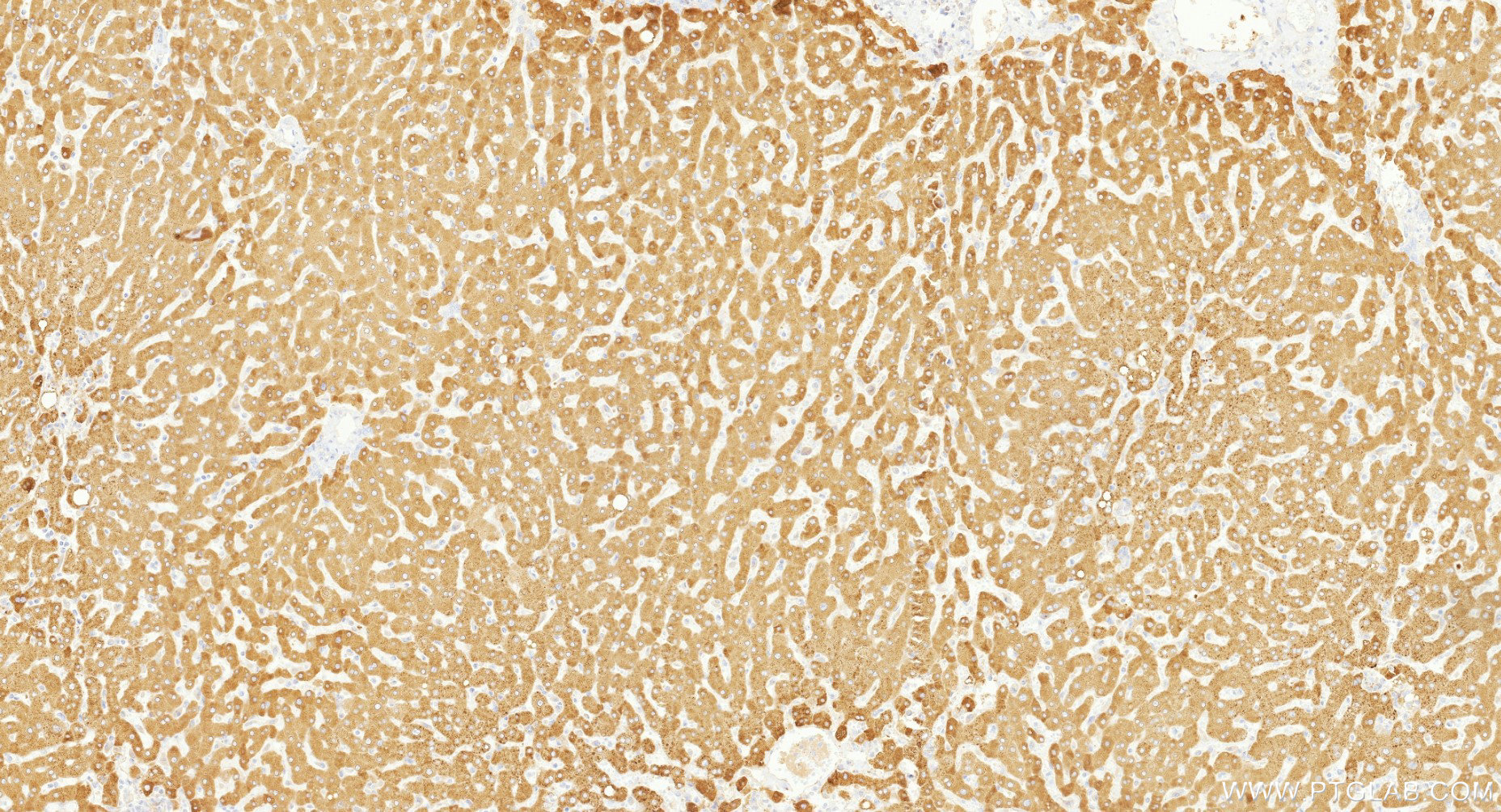 IHC staining of human liver using 86982-1-RR (same clone as 86982-1-PBS)