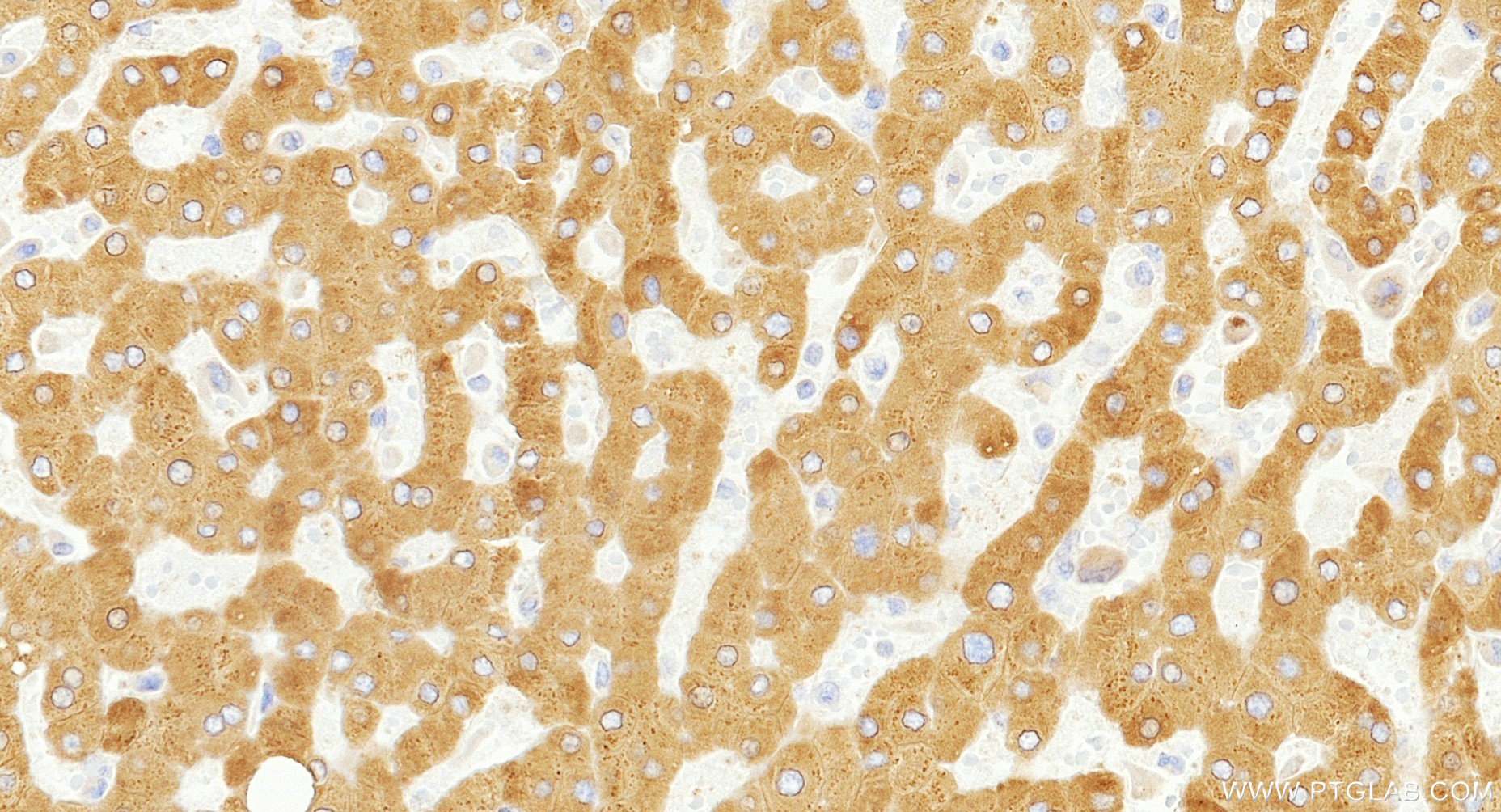 IHC staining of human liver using 86982-1-RR (same clone as 86982-1-PBS)