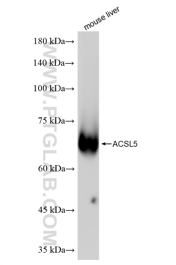 WB analysis of mouse liver using 86982-1-RR (same clone as 86982-1-PBS)